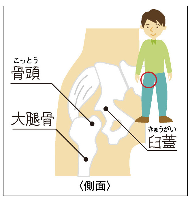 の 違和感 足 付け根