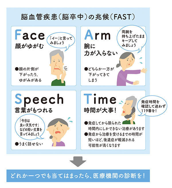 Time Is Brain è„³å'ä¸­ã¯æ™‚é–